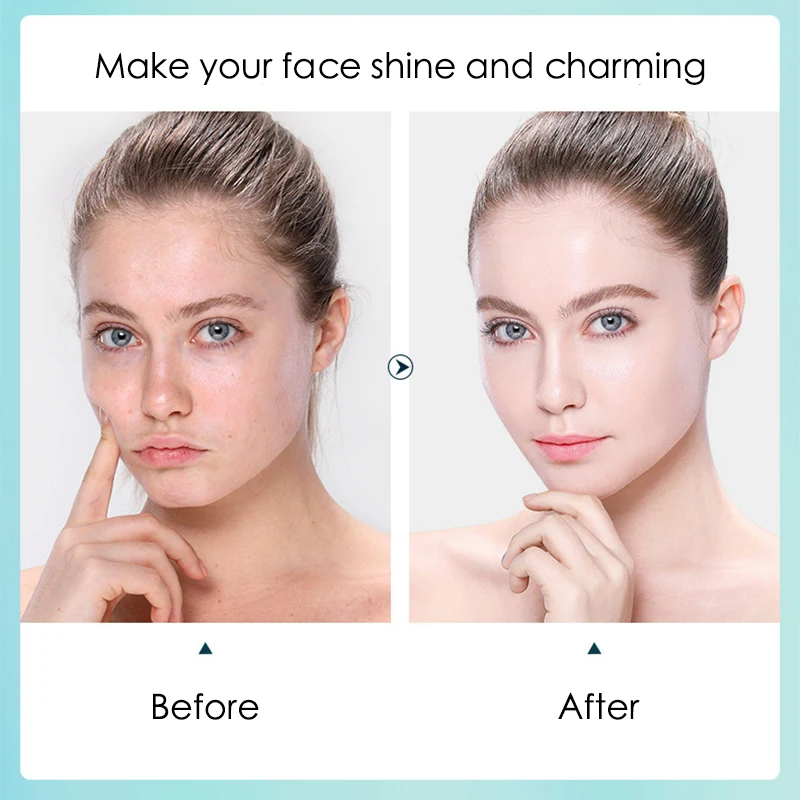 10 stks Hyaluronzuur Hydratere - Sheet Mask Collagen recensie en prijs